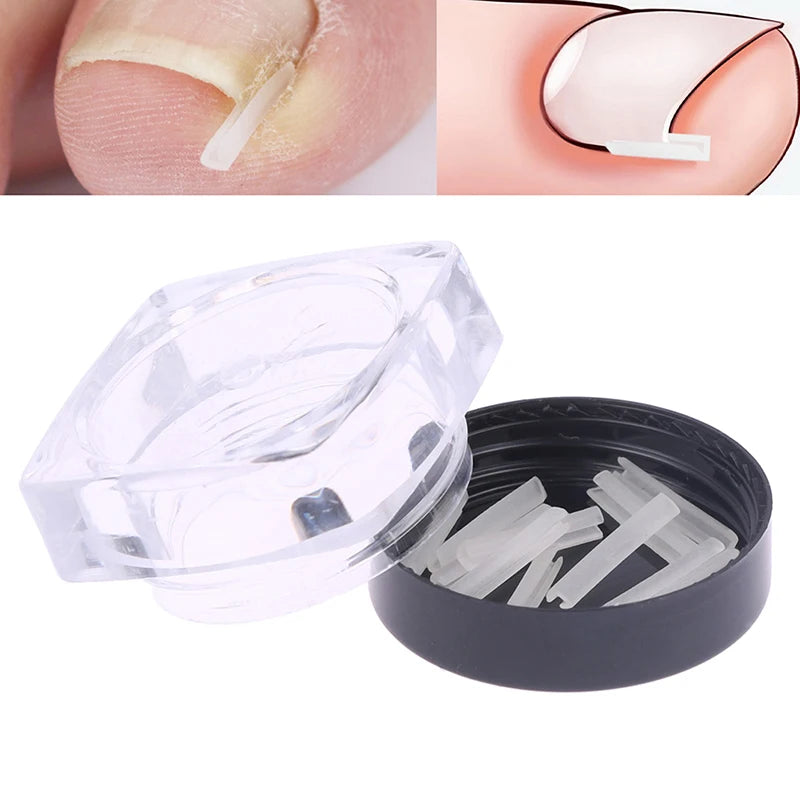 10Pcs Paronychia Treatment Recover Corrector Pedicure Tools Nail Correction Stickers Ingrown Toenail Corrector Patches