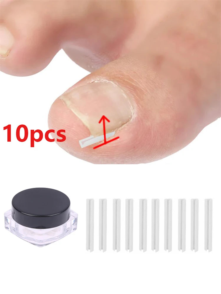 10Pcs Paronychia Treatment Recover Corrector Pedicure Tools Nail Correction Stickers Ingrown Toenail Corrector Patches