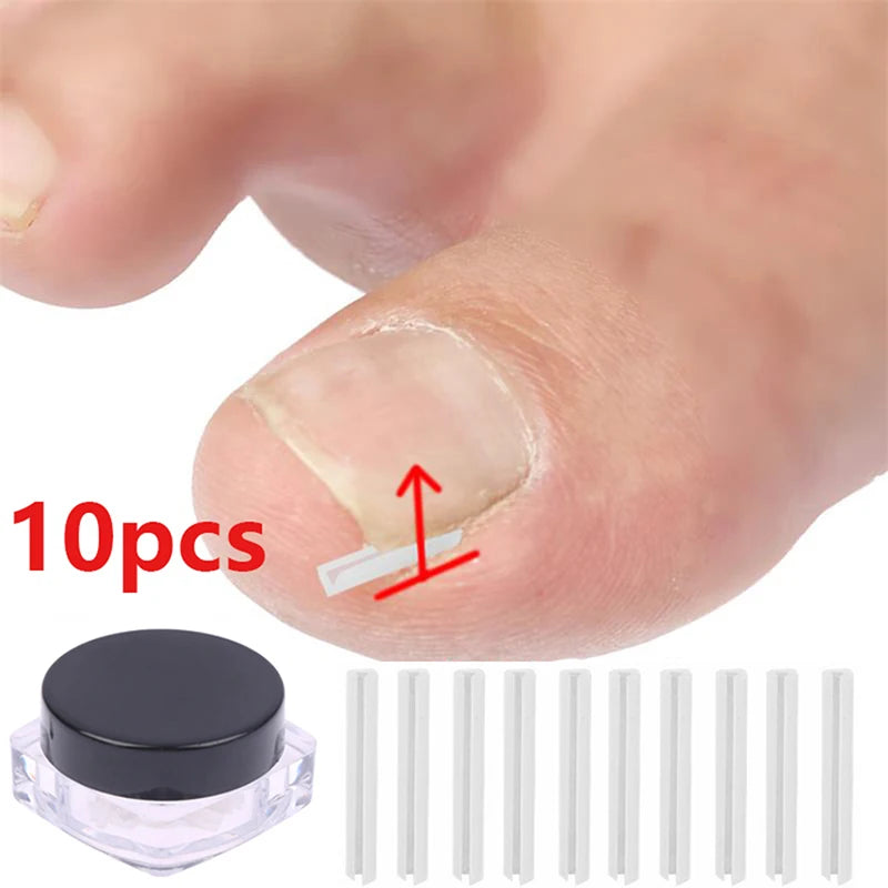 10Pcs Paronychia Treatment Recover Corrector Pedicure Tools Nail Correction Stickers Ingrown Toenail Corrector Patches