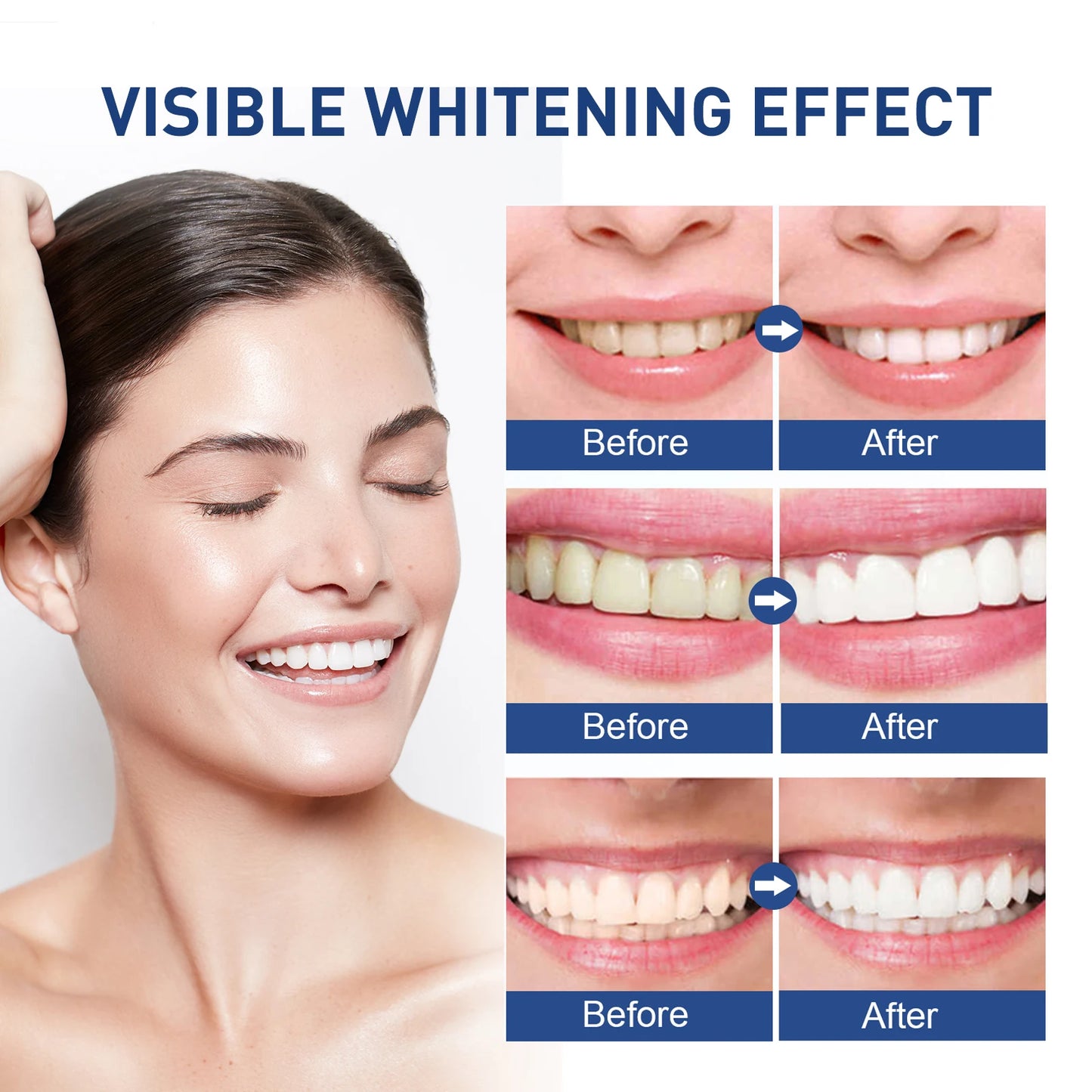 Instant Teeth Whitening Paint 5ml Remove Stains and Yellow Teeth Fast Acting Smile Brightener No Sensitivity Vegan Formula