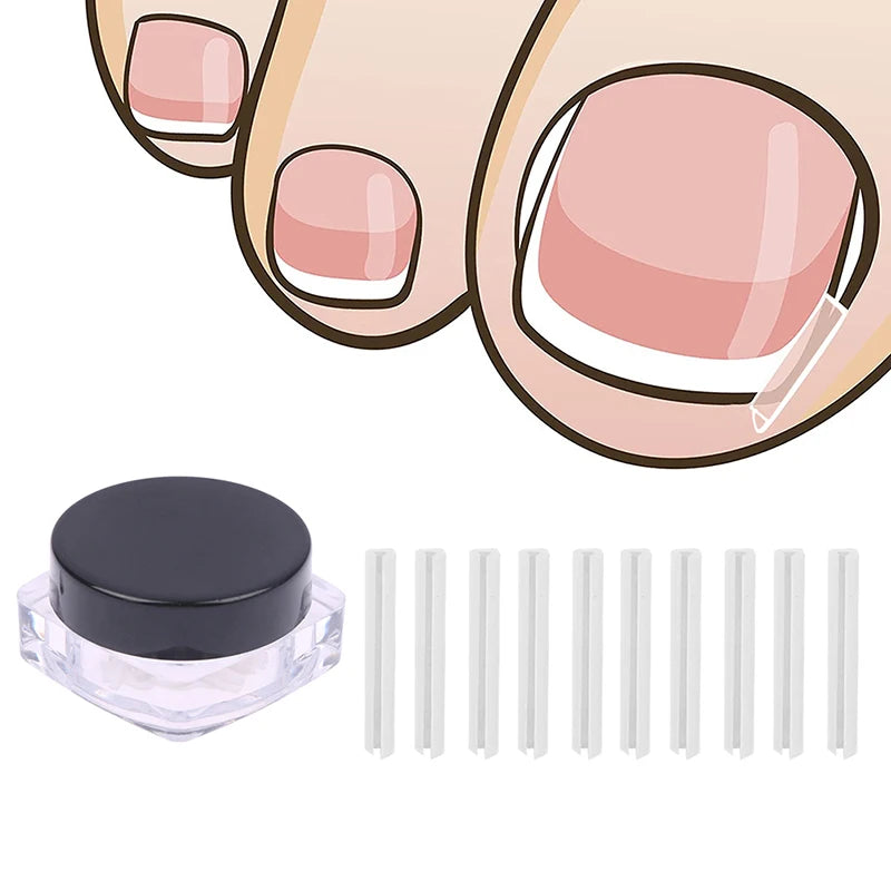 10Pcs Paronychia Treatment Recover Corrector Pedicure Tools Nail Correction Stickers Ingrown Toenail Corrector Patches