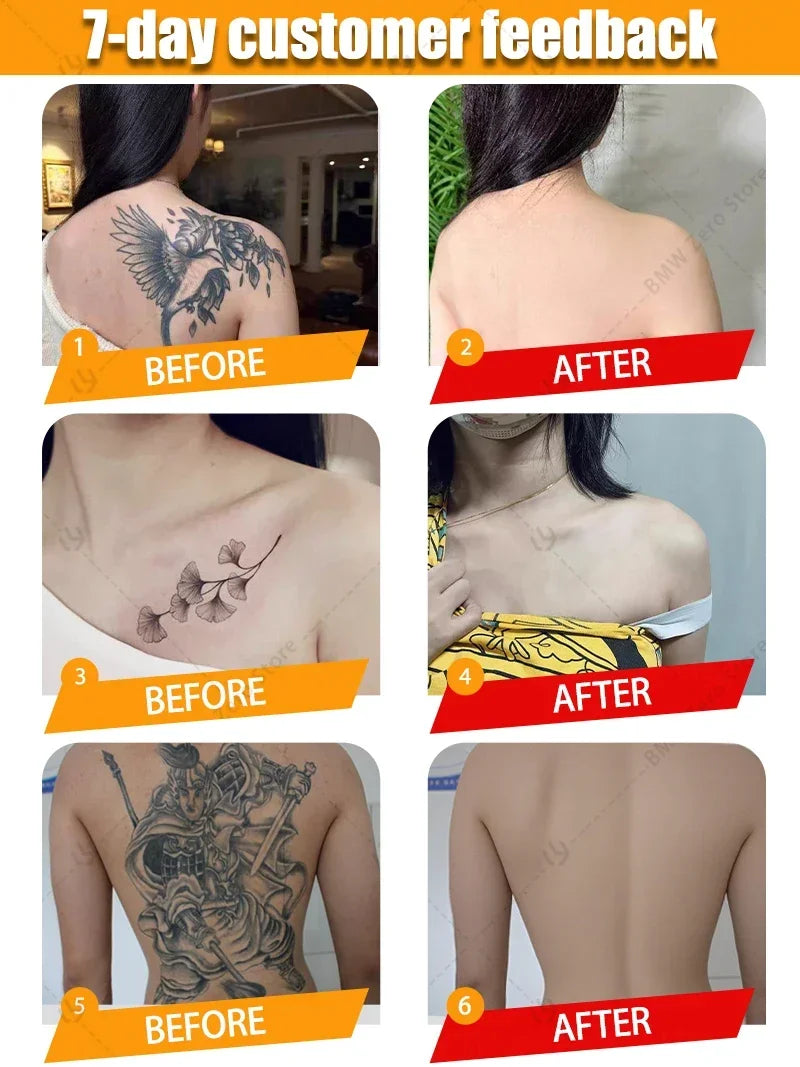 Instantly removes tattoos, disintegrates pigments, and repairs damaged skin without leaving scars